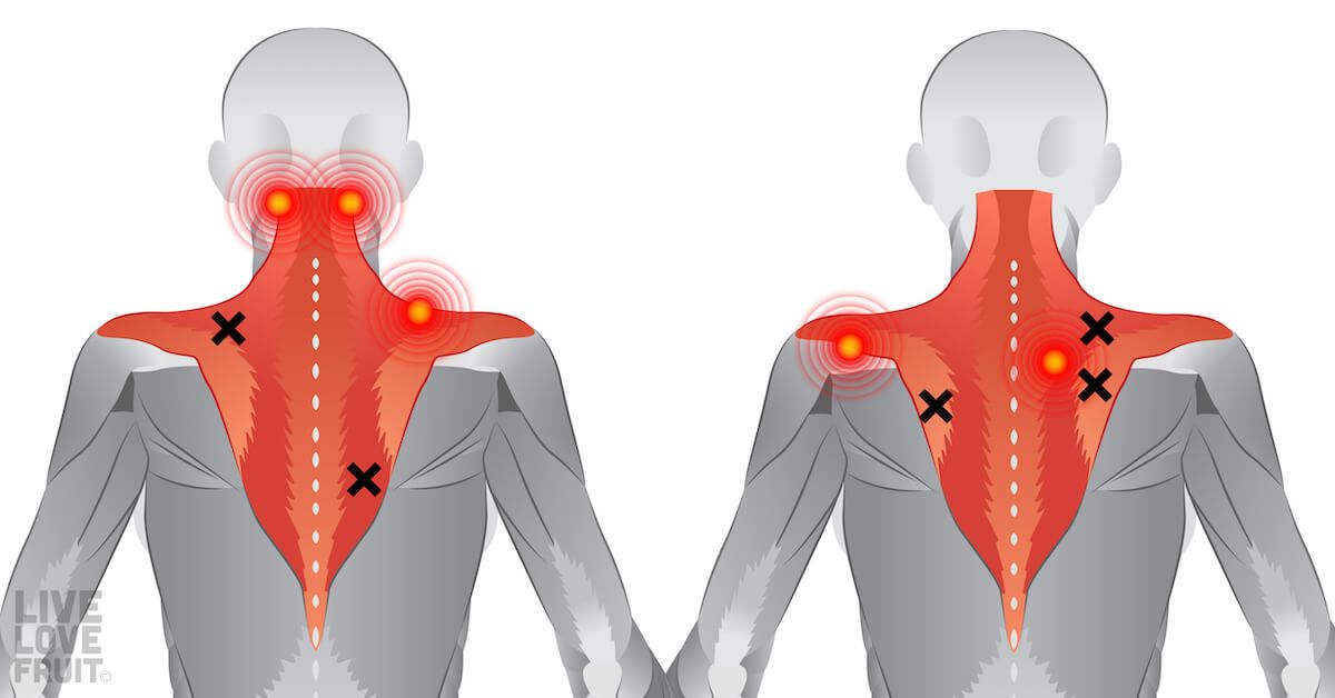 How Stiff and Tight Muscles Can Lead to Back Pain